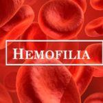 Hemofilia – co wiemy o tej chorobie?